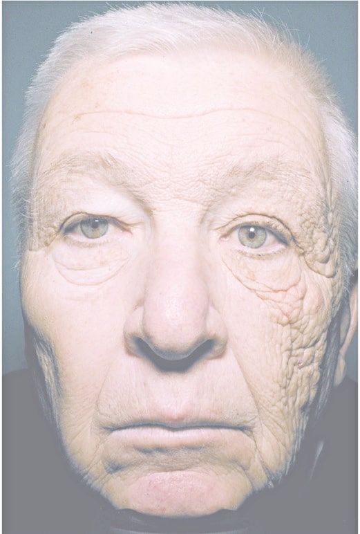 世界でもっとも権威ある週刊総合医学雑誌の一つ「ニューイングランド・ジャーナル・オブ・メディシン」に掲載された69歳のトラック運転手の画像
